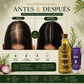 Shampoo de Romero X 500ml + Tratamiento  Acondicionador de Uva X 90ml (Precio Especial)
