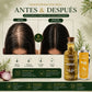 Shampoo de Romero 500ml Gratis Acondicionador de Uva X 90ml